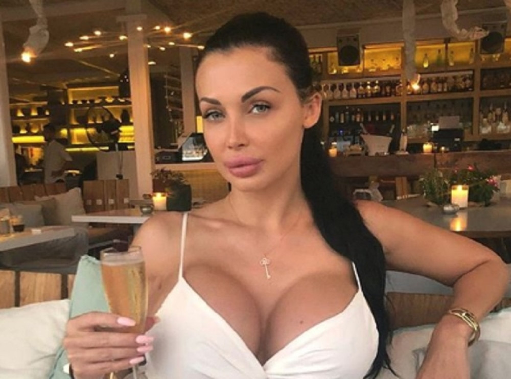 Porno glumica je toliko PRETERALA SA SILIKONIMA, da joj se ZADNJICA skroz IZDEFORMISALA!