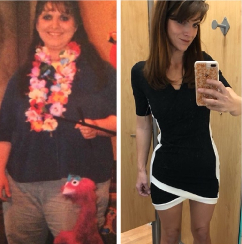 SMRŠALA 60 KILOGRAMA, A JELA JE SAMO TRI NAMIRNICE: Za kratko vreme dovela je liniju do savršenstva!