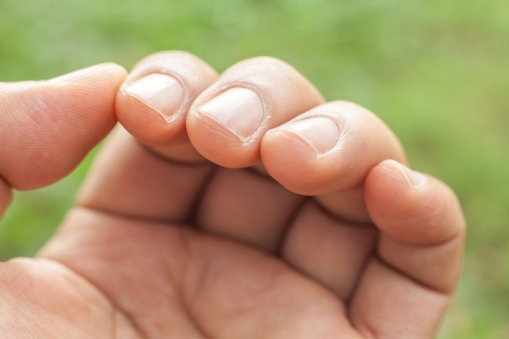 Jednostavan test koji otkriva rak pluća u ranoj fazi! Obratite pažnju na izgled noktiju
