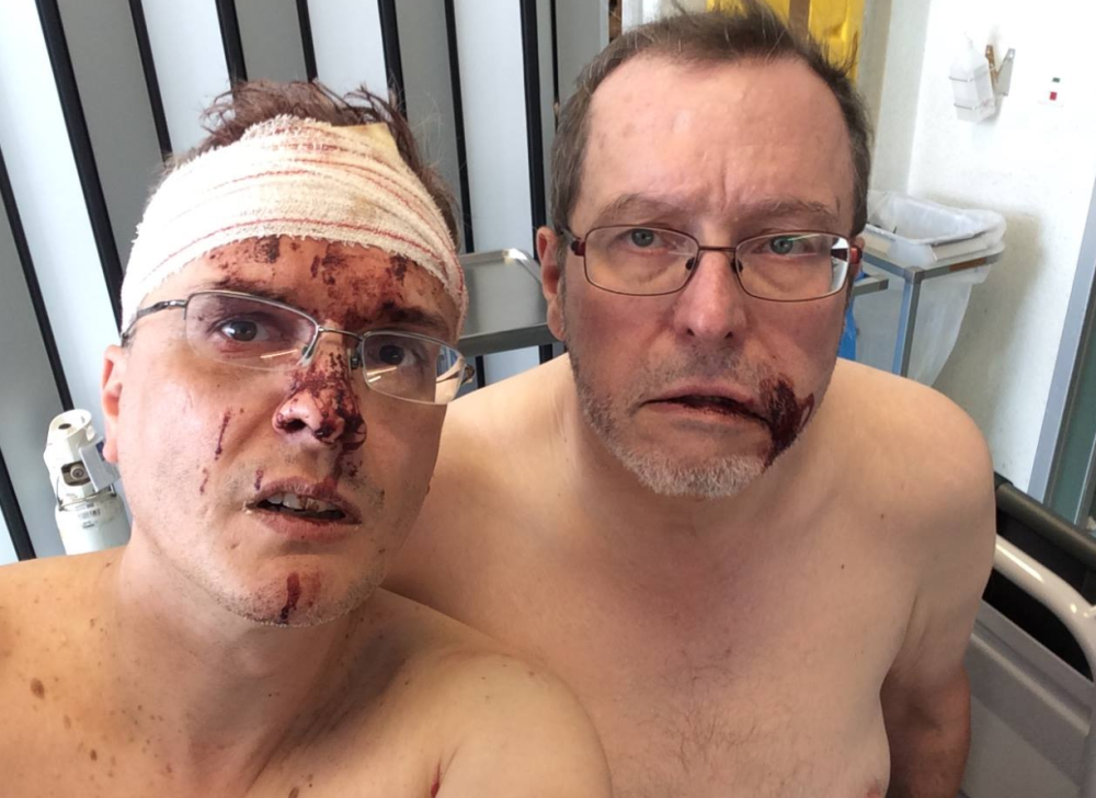 JASMINA SA DEČKOM GODINAMA TUKLA GEJ KOMŠIJE Italijana i njegovog muža sačekali na parkingu i prebili METALNOM ŠIPKOM (FOTO)