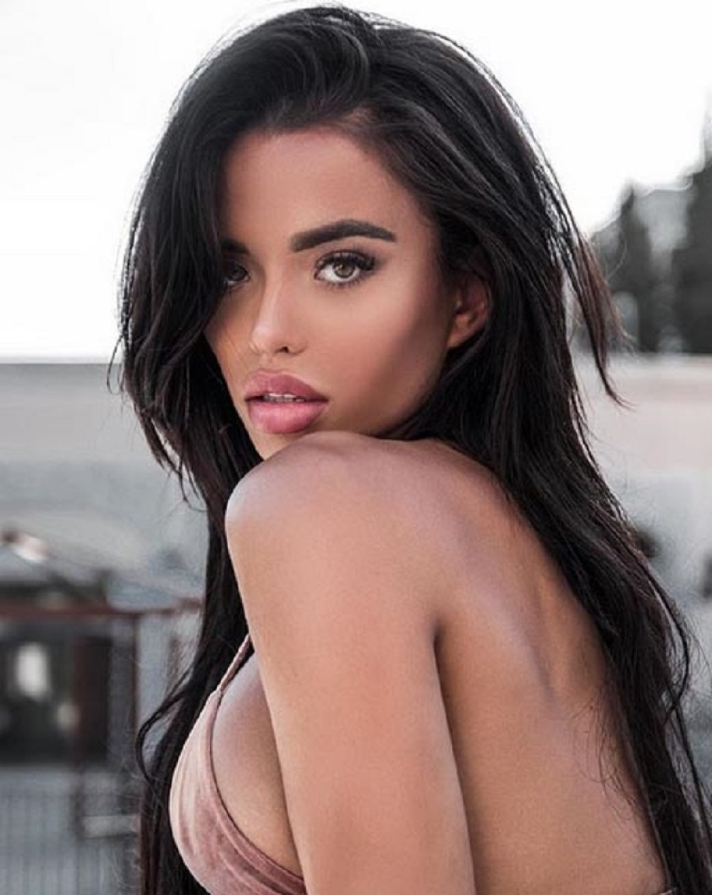 Misica ranjena na Galenici u teškom stanju, jedna osoba je sve vreme uz nju!