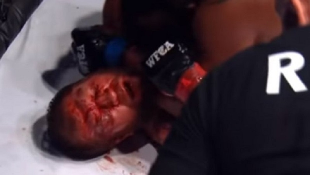 MMA borac ODVALJEN OD BATINA, ležao u lokvi krvi, a NIJE IZGUBIO!!! (VIDEO)