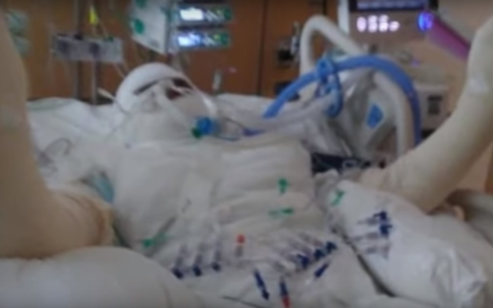 Devojčici IZGORELO POLA TELA kada je pristala na stravičan izazov koji se širi među tinejdžerima!