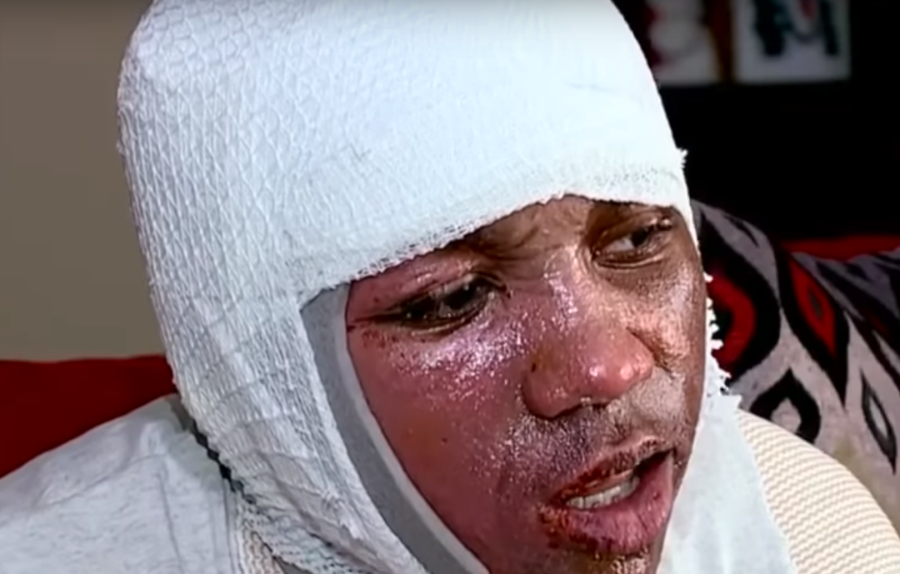 Novi opasni izazov zaludeo decu, posledice su JEZIVE