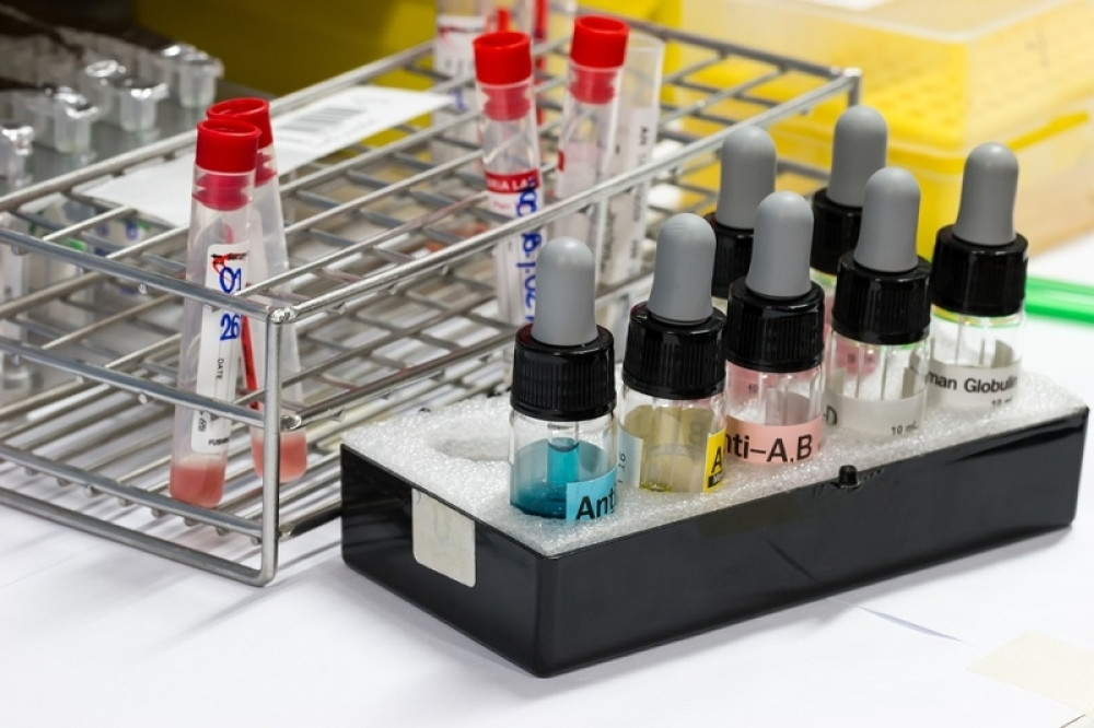 Sad je veoma važno, naredni period će biti kritičan