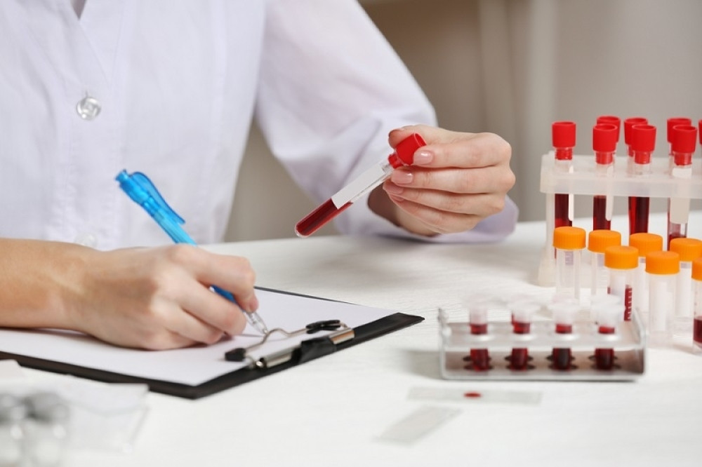 Nemački naučnici jednostavnim testom krvi mogu da predvide smrt!