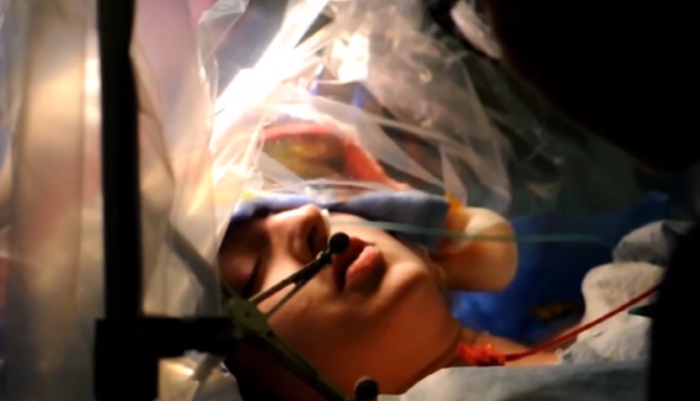 Komičarki su operisali tumor na mozgu, bila je svesna, a ono što je radila tokom operacije RASPLAKAĆE VAS! (VIDEO)