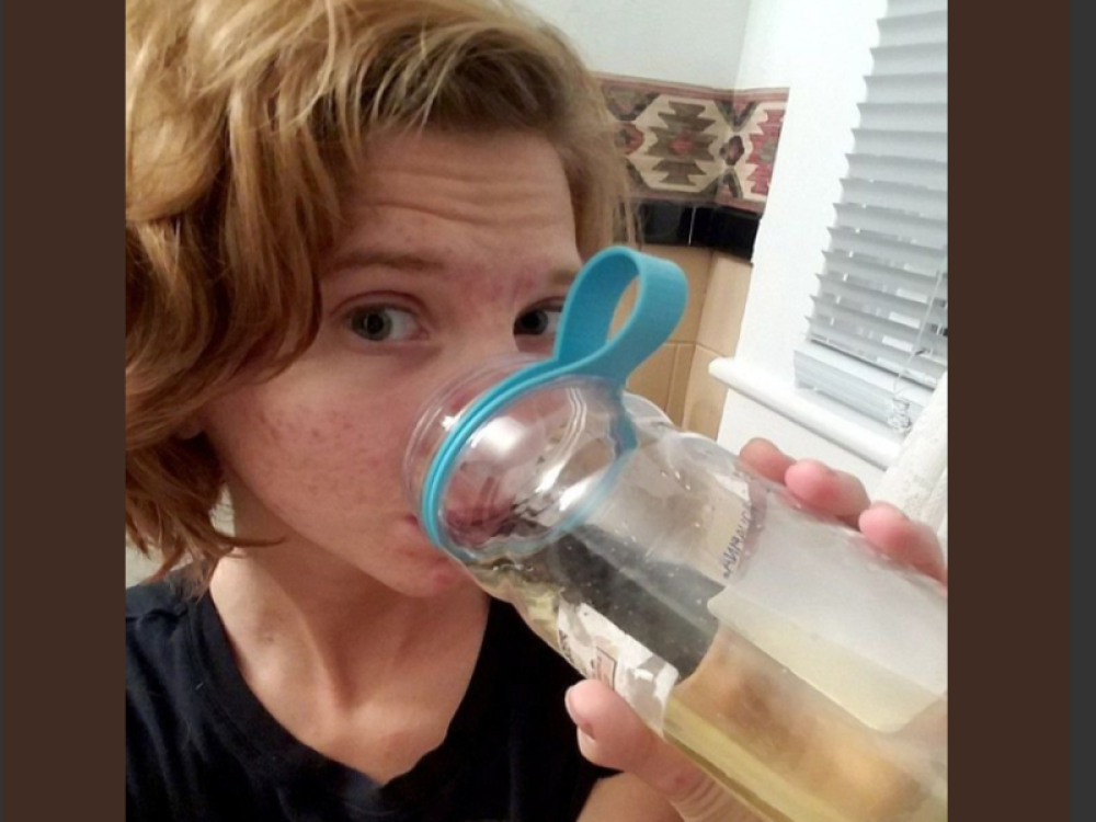 Julija svako jutro pije svoju telesnu tečnost i trlja je po licu, tvrdi da joj pomaže iako lekari BESNE