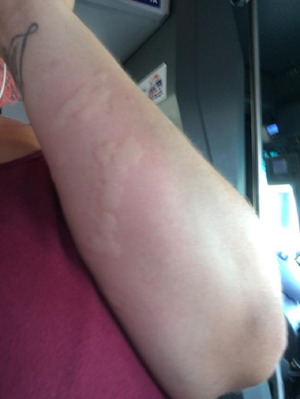 MIRNO SE VOZILA GRADSKIM PREVOZOM, A ONDA JE POČEO HOROR... "Kada sam videla sedište - skamenila sam se!" (UZNEMIRUJUĆ FOTO + VIDEO)