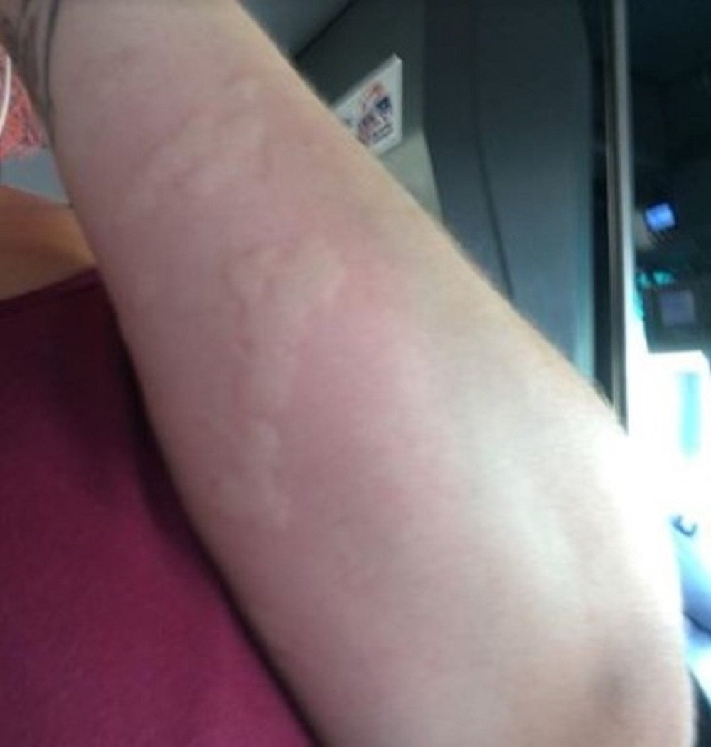 Sedela je u autobusu i odjednom je zasvrbela ruka, kad je pogledala sedište ostala je u šoku! (VIDEO)