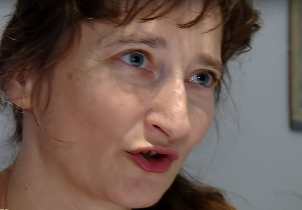 Probudio me bol, mislila sam da me je nešto ujelo, a onda sam videla kako mi nešto GMIŽE U OKU (VIDEO)