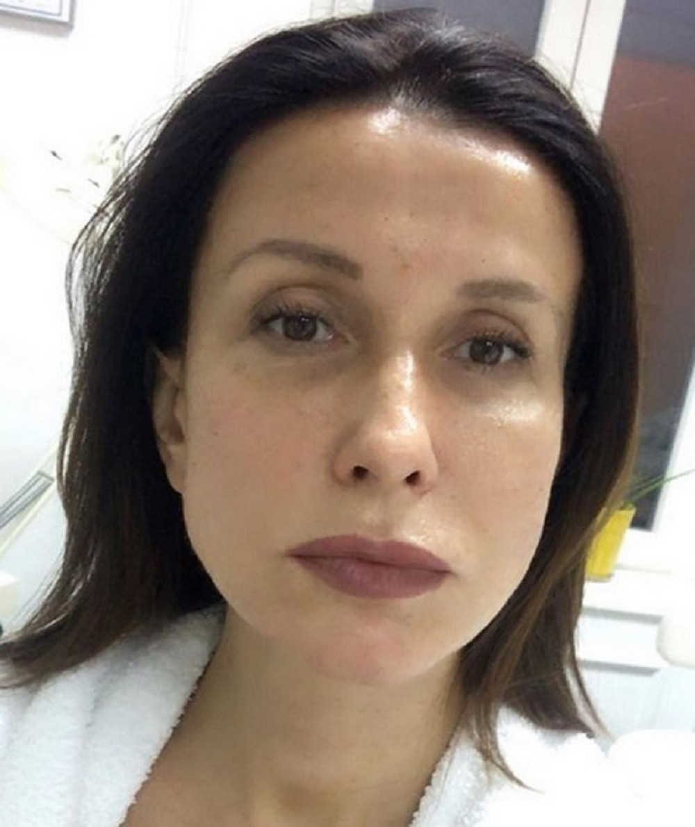 Napad na Snežanu Dakić nakon oglašavanja iz izolacije! (VIDEO/FOTO)