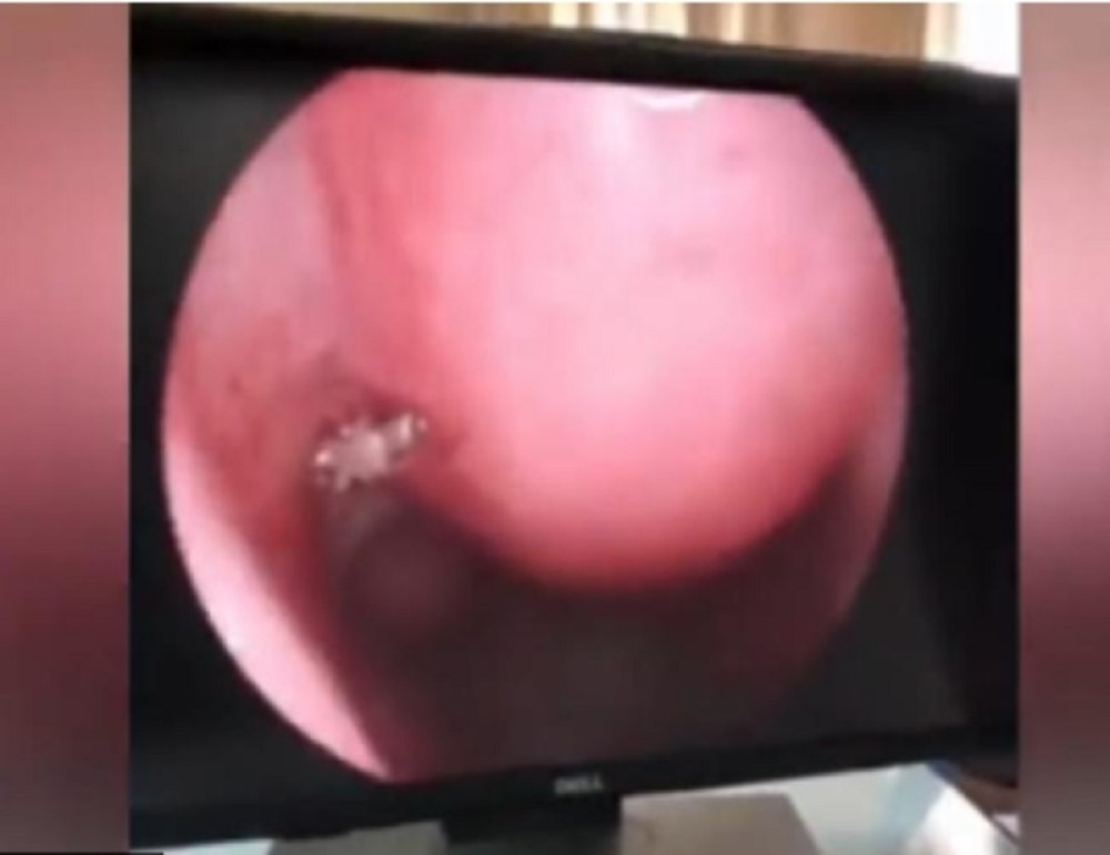 NOS GA JE STRAŠNO SVRBEO: Otišao je na snimanje kod lekara, a onda ih je šokiralo šta su zatekli unutra (VIDEO)