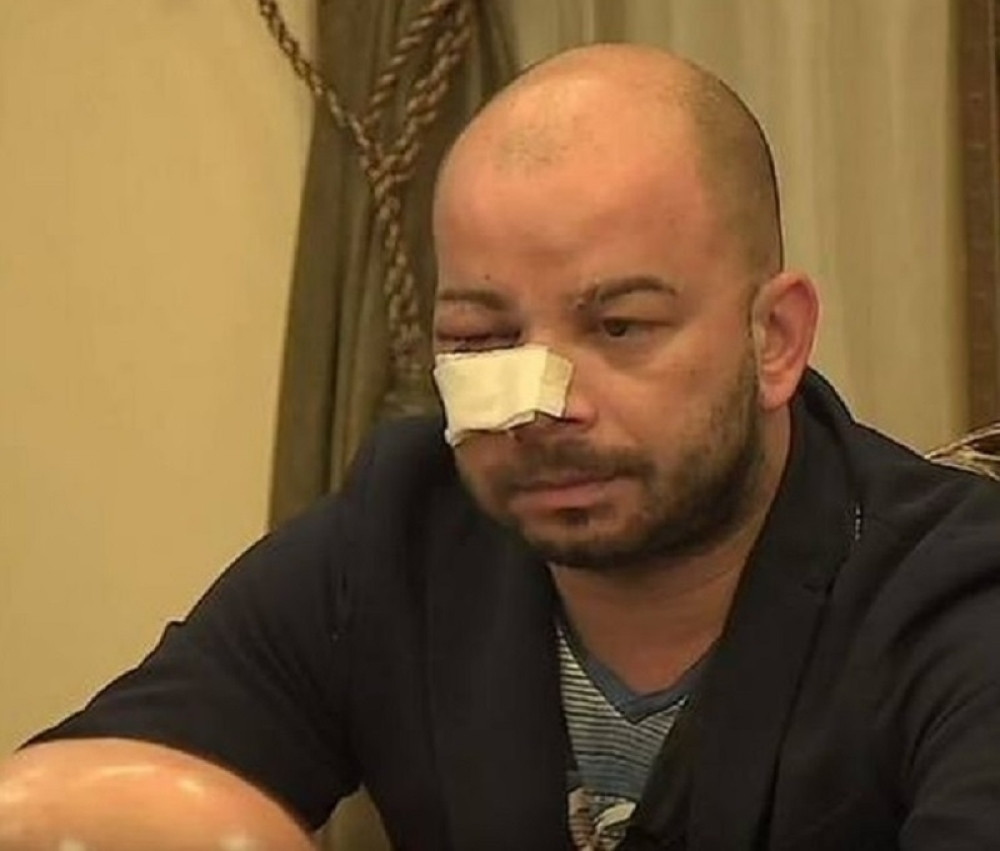 Učesnici šokirali tvrdnjom: "Miliju je slomljen nos" (VIDEO)