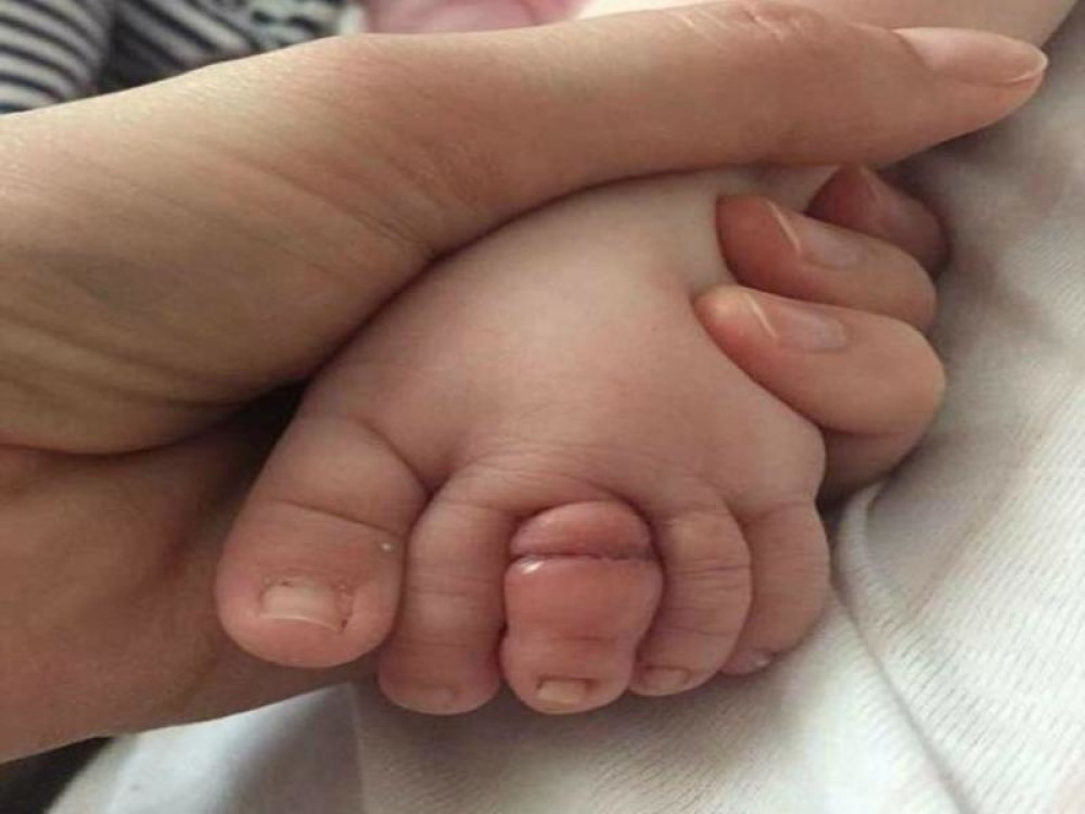 Zbog ovoga je mogla da ostane BEZ PRSTA, a može svakom da se desi!