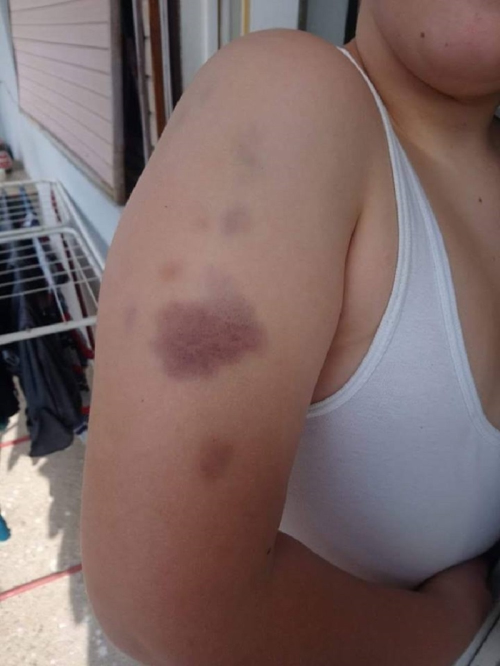 Zove se CIMKA, a dete stane u položaj mirovanja, dok ga svi okruže i što jače udaraju ukoliko uradi jednu stvar