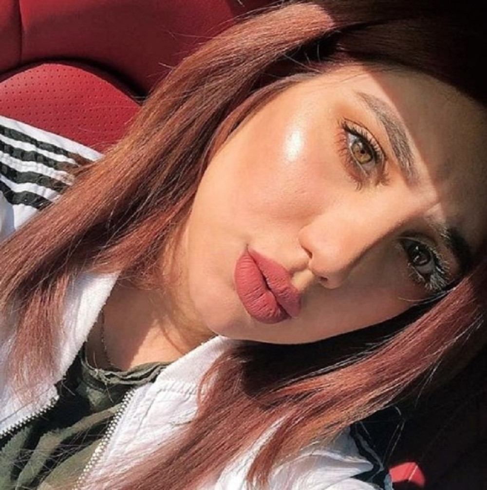 STRAHOTA: Misica ubijena u centru grada (FOTO+VIDEO)