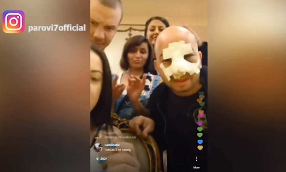 MILIJU SE STANJE POGORŠALO Još se nije oporavio od brutalnih batina, celo lice mu u zavoju! (FOTO)