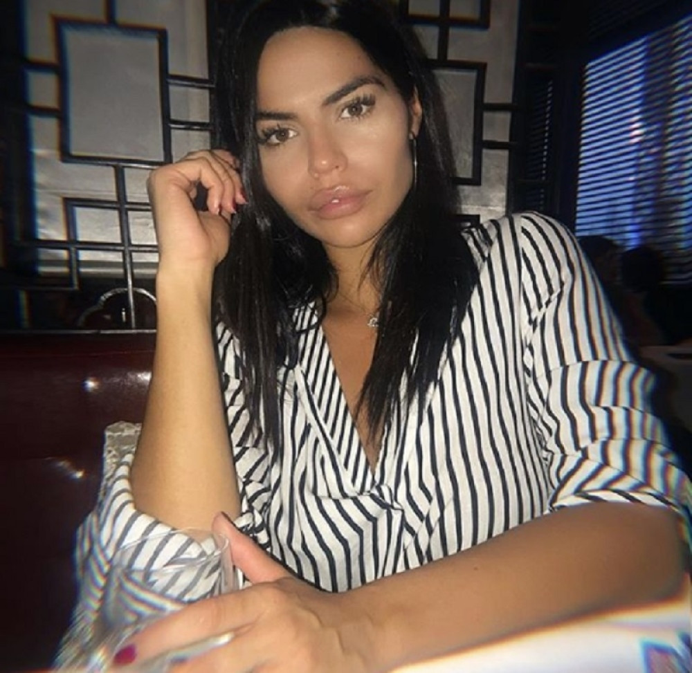 PREŽIVELA UDES ZBOG KOJEG JOJ SE LICE UNAKAZILO: Dejana Živković prošla kroz pakao, otkriveni dugo skrivani detalji!