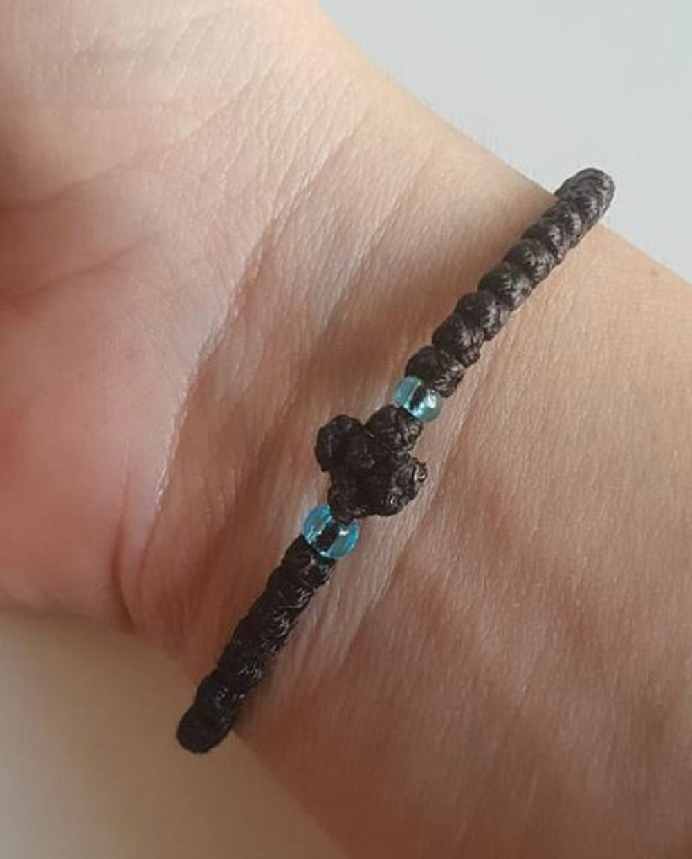 Vernici, evo šta treba uraditi sa brojanicom ako pukne!