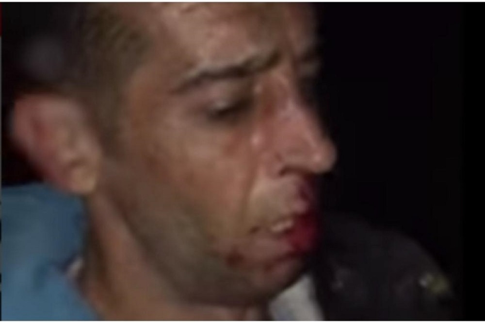 Lomili su nam kosti na granici! OBJAVLJEN STRAVIČAN SMIMAK PREBIJANJA (VIDEO)