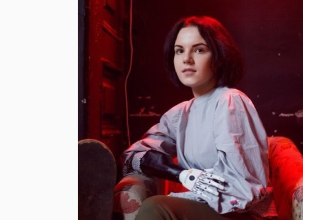 Margariti je ljubomorni muž sekirom odsekao obe ruke, a svet je zanemeo nad stravičnim slikama (VIDEO)