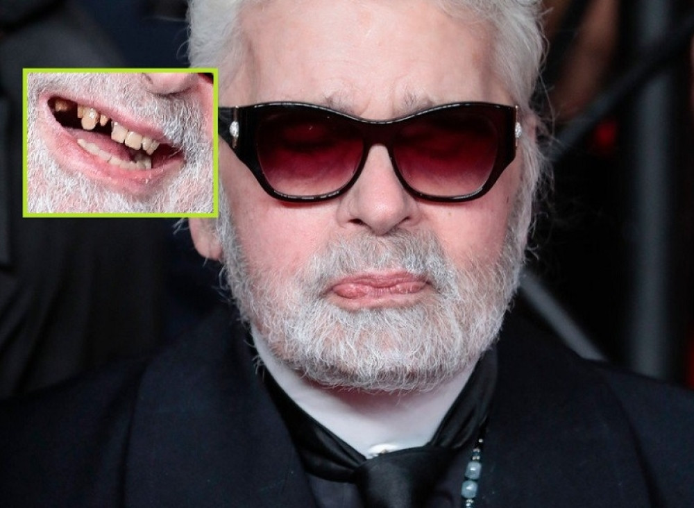 KRALJ MODE SE NIKADA NE SMEJE I SAD NAM JE JASNO ZAŠTO: Razvukao je širok osmeh i svima zgadio život! (FOTO)