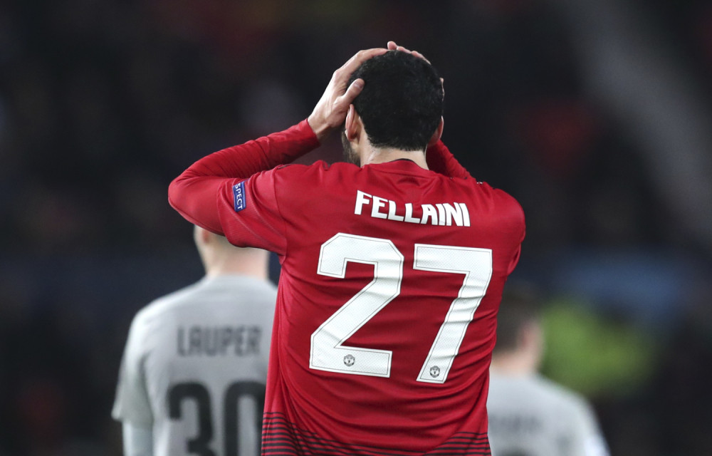 Felaini u epizodi: Hoću SVOJU KOSU nazad! (VIDEO)