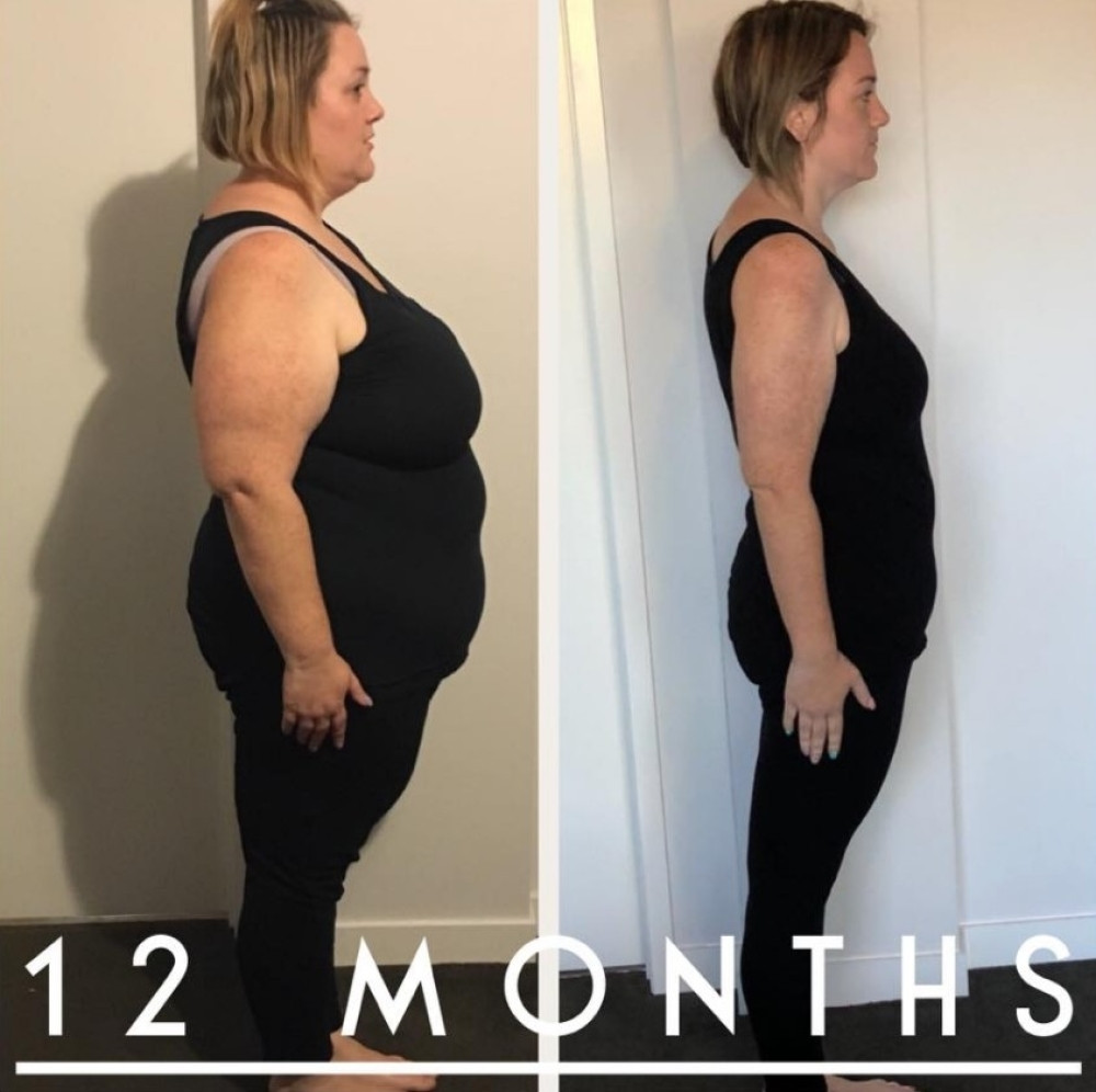 Imala je 127 kilograma i nije mogla da veže pojas u avionu! Uradila je jednu stvar i izgubila čak 62 kilograma!