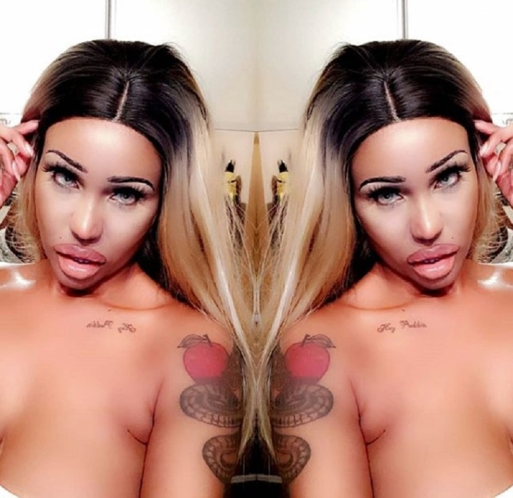 Ovoj ženi lakari su ZABRANILI estetske operacije: Govore mi da sam FEJK, ali baš to želim! (FOTO)