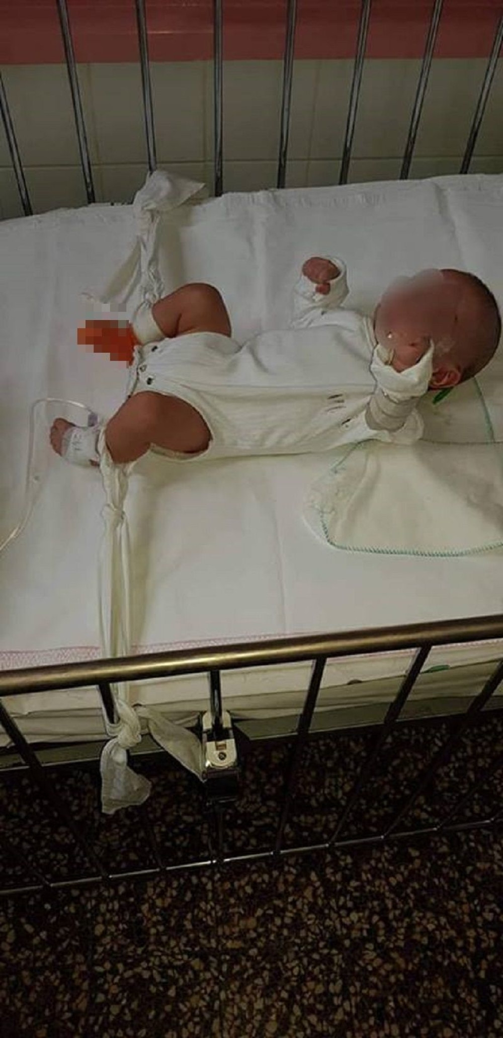 Lekari se bore za život bebe na koju je naleteo auto dok ju je majka vozila u kolicima