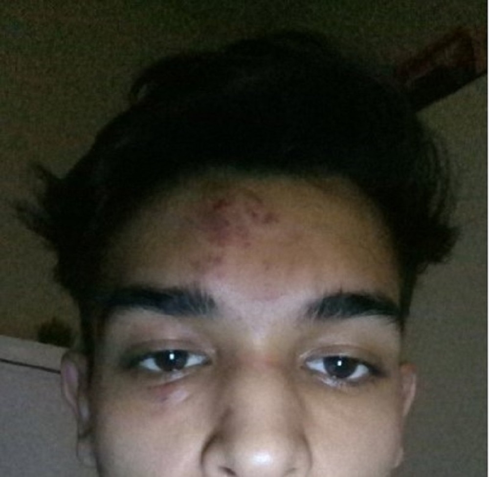 Mladi pretučeni Rom objavio sliku modrica i svima posalo poruku! Usledilo je brdo komentara (FOTO)