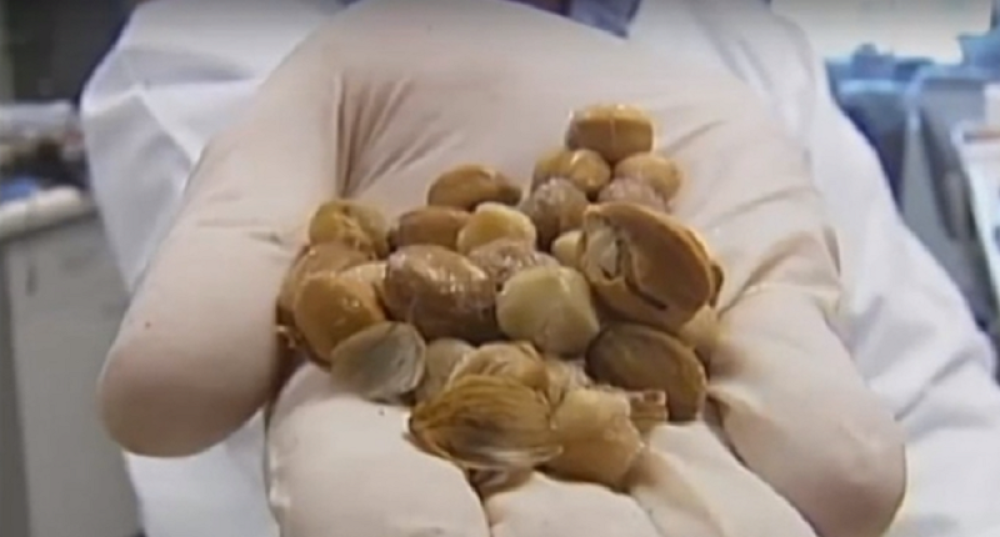 Naučnici otkrili PRIRODAN LEK! Milioni obolelih su ponovo dobili NADU za zdrav život! (VIDEO)