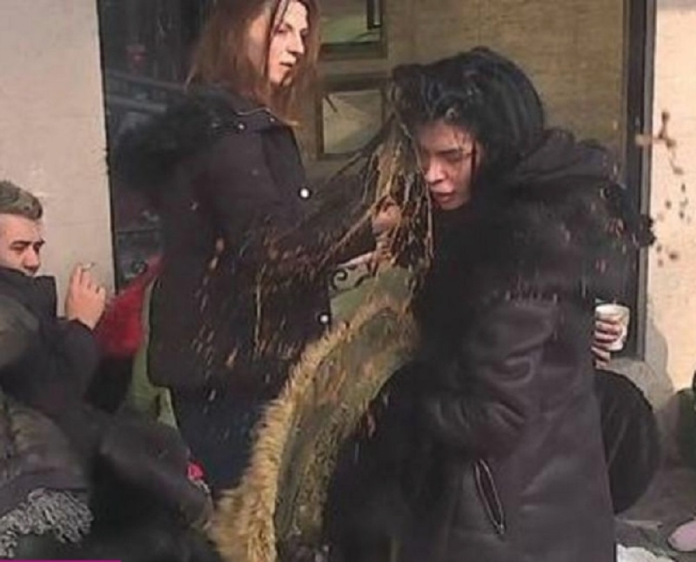 Ispolivala je vrelom kafom! Alarmantno stanje, sva ISPEČENA (FOTO)