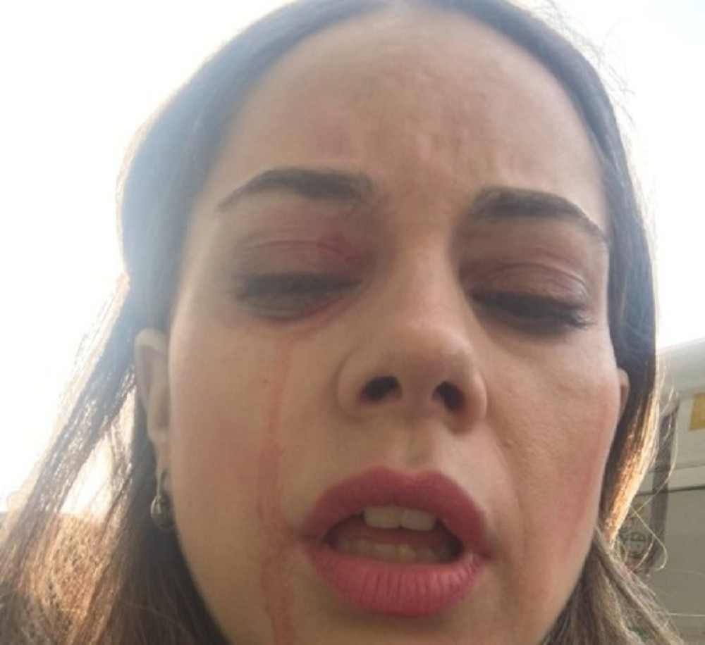 Čovek brutalno pretukao devojku na Zelenom vencu u autobusu 95! (FOTO)