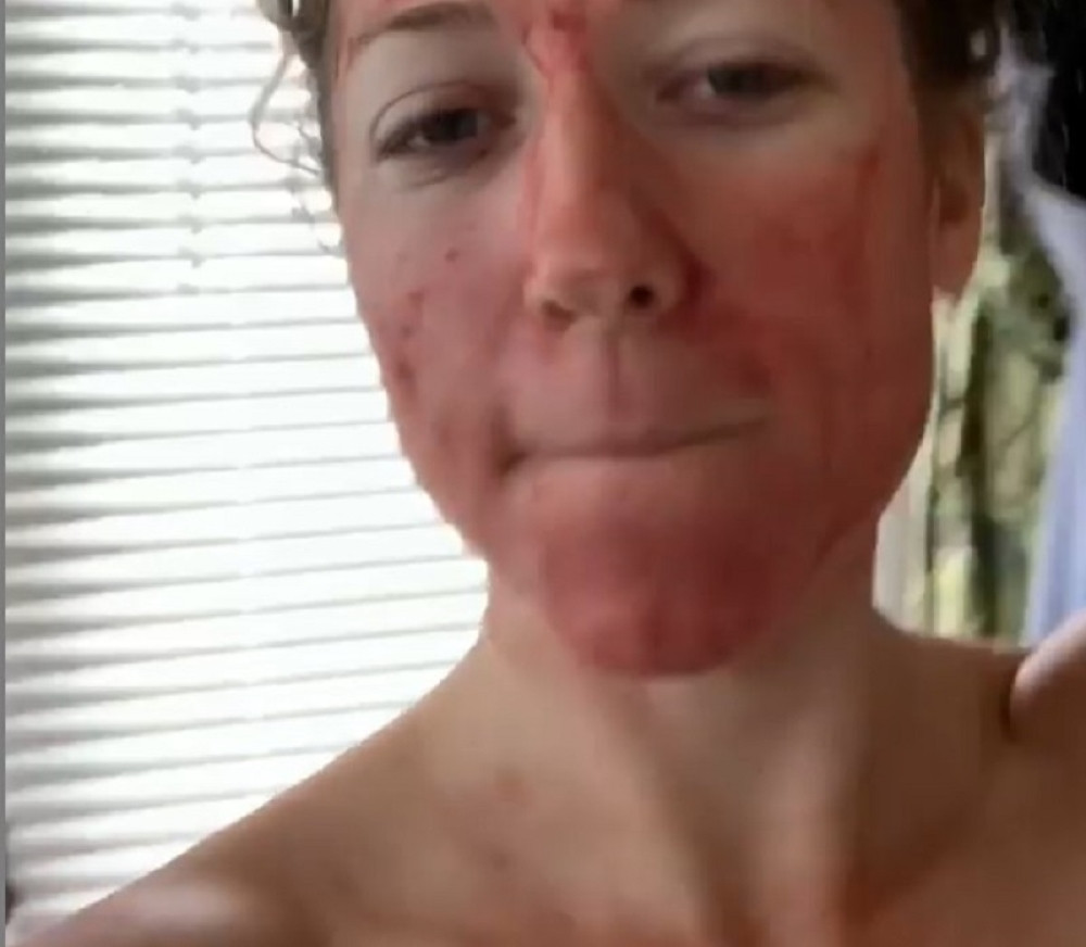 Čim dobije, lice maže krvlju, pa fotku okači na Instagram, a evo šta se krije iza svega!