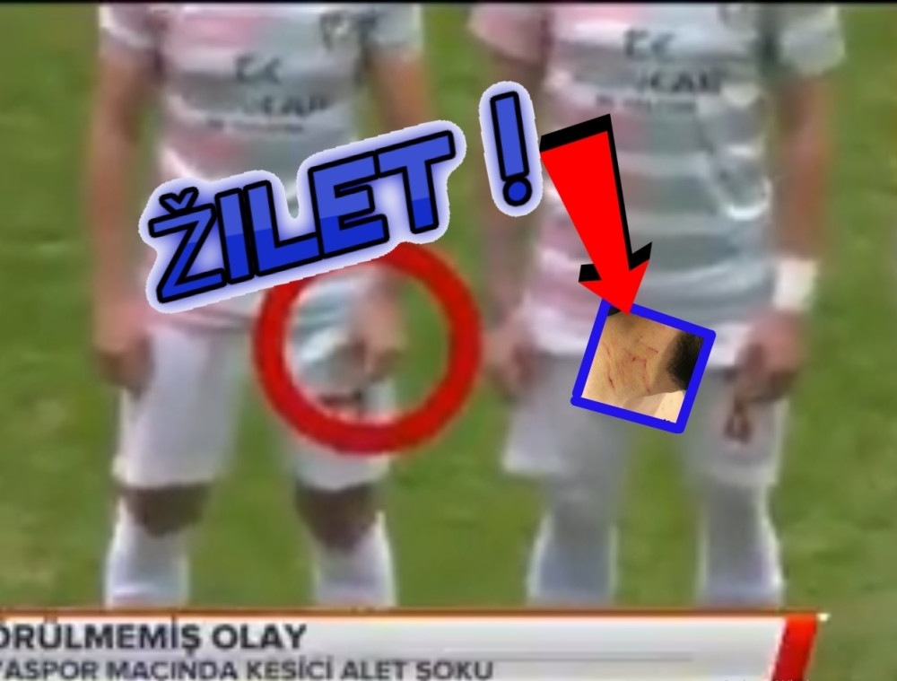 Ludak pomilovan! OVAJ KRVNIK će ponovo seći žiletom igrače na terenu! (VIDEO)