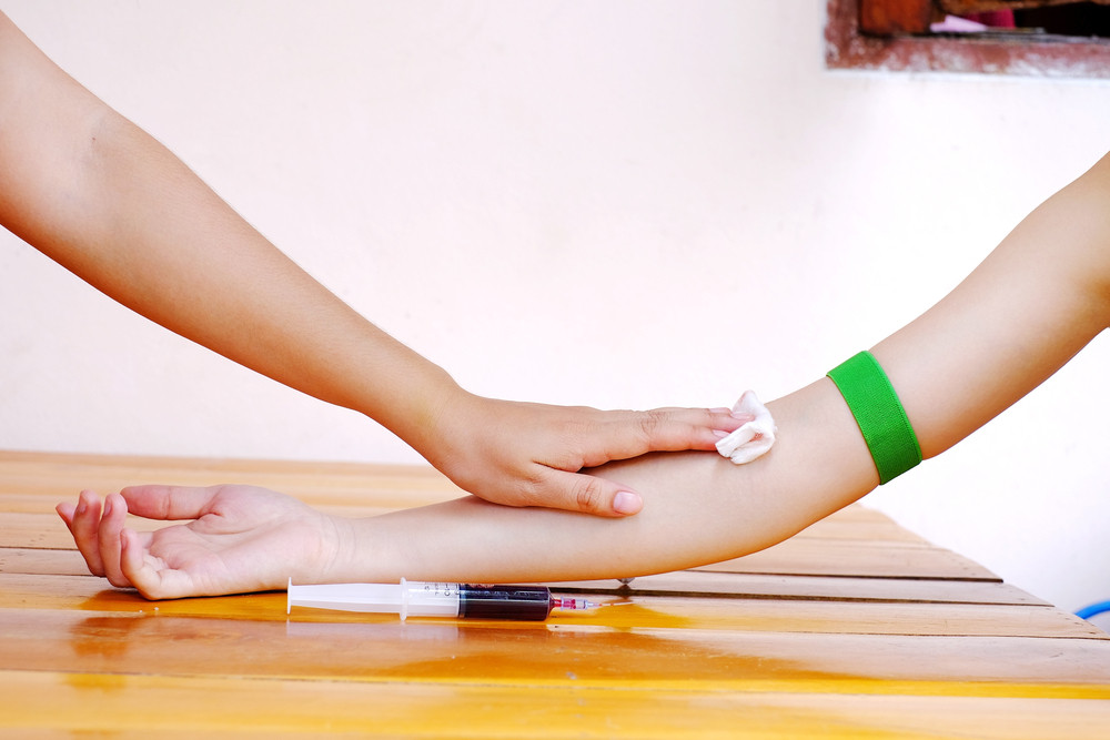 Svi se plaše kada SANJAJU KRV, a niko da zna da to u OVOM SLUČAJU donosi veliku sreću!