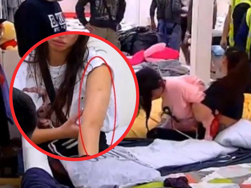 Nakon Krunićkinog prebijanja Maja pljuvala krv, modrice i podlivi na sve strane!