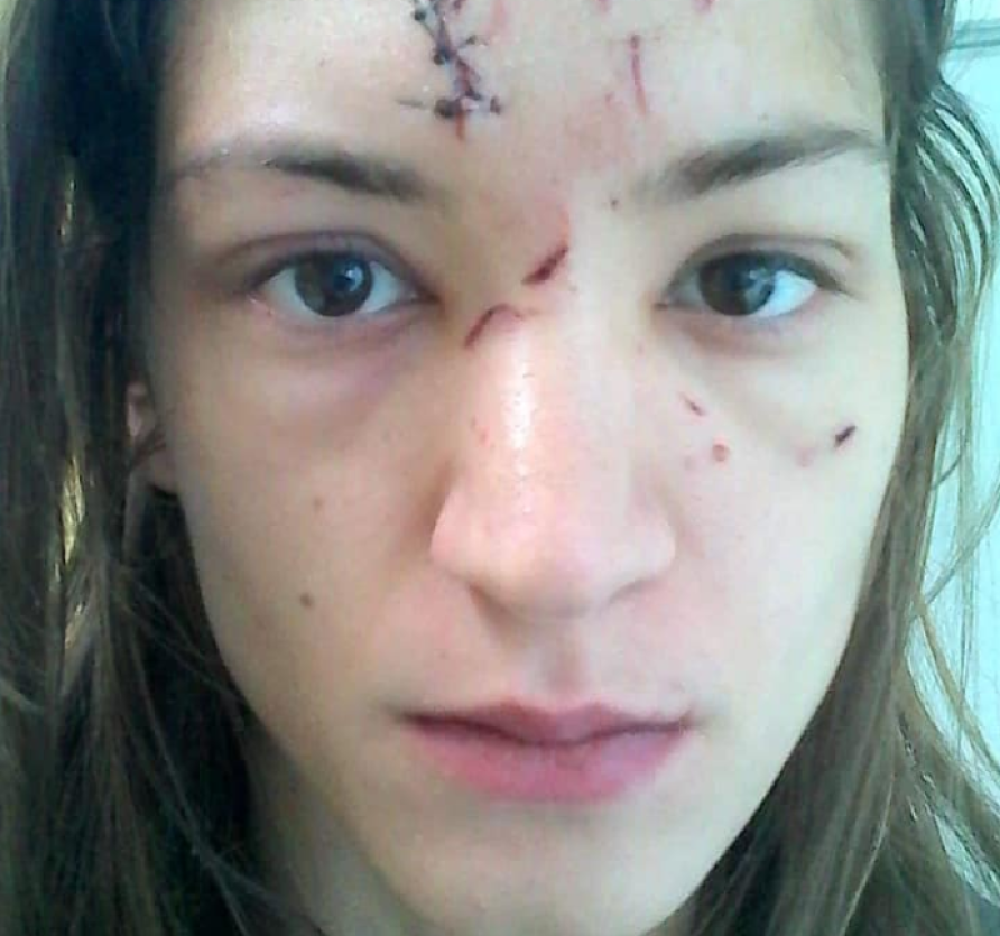 Razbio joj čašu o lice, a kada se na njenim vratima pojavio Dejanov otac, Mara je odlučila da sve obelodani (FOTO)