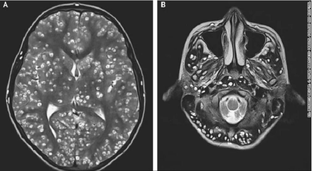 Tinejdžer je došao u bolnicu zbog epileptičnih napada, ali kada su shvatili šta ih uzrokuje lekari su ostali ZAPANJENI
