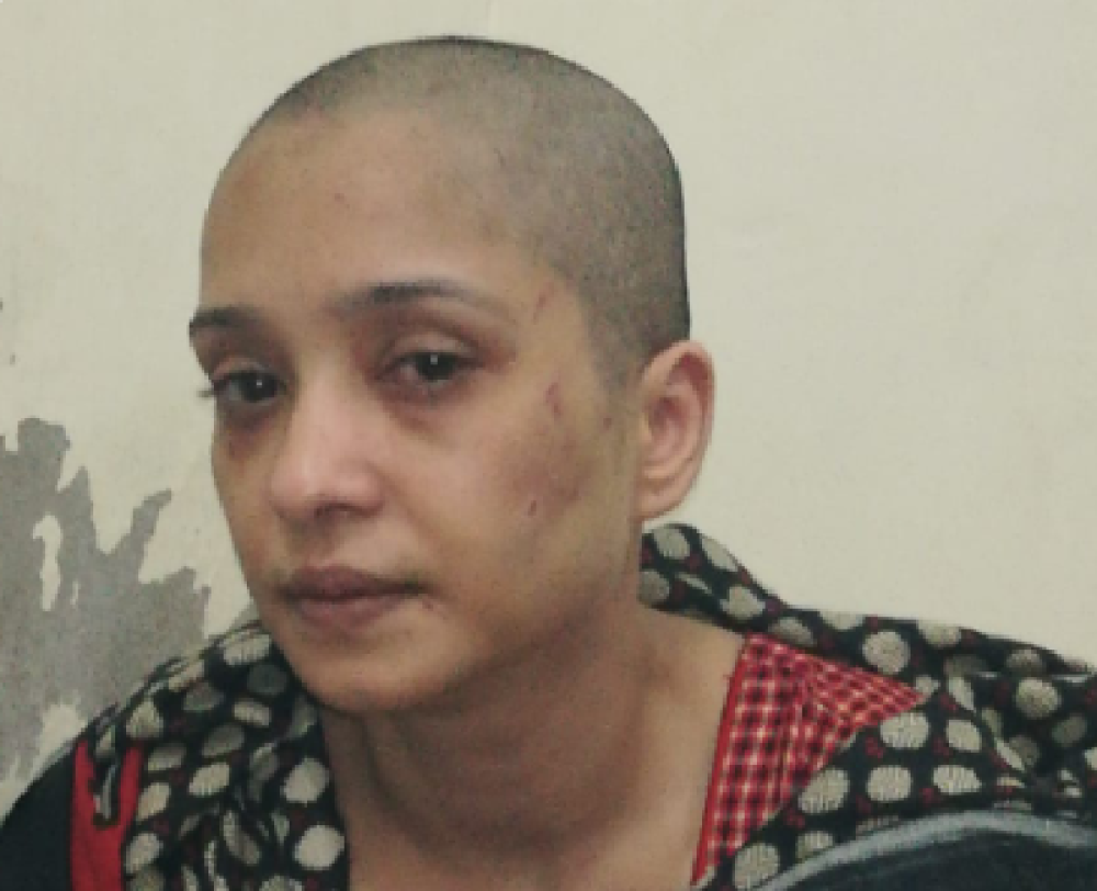 Muž tražio da mu igra gola, a kad je odbila, pretukao je pred prijateljima i obrijao joj glavu (FOTO)