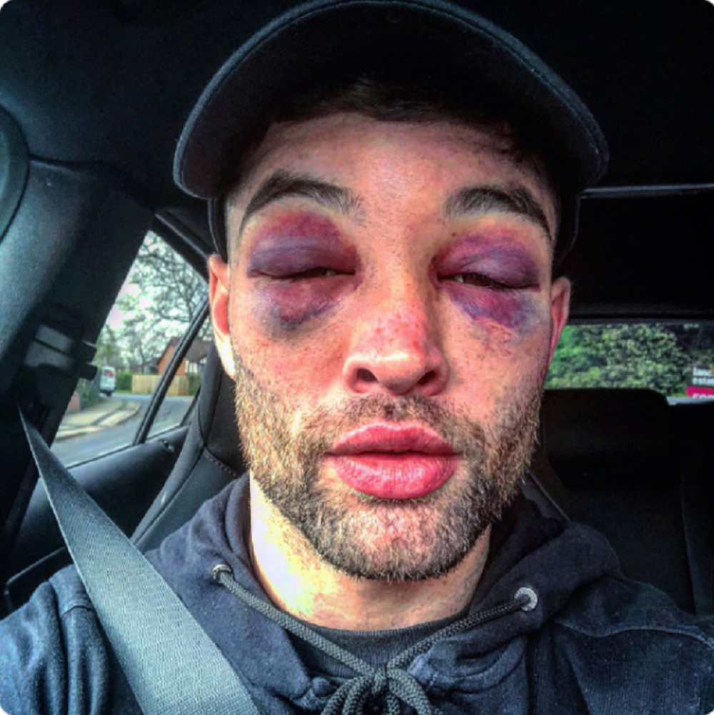 Ako ovako izgleda pobednik posle bokserskog meča, kako onda izgleda gubitnik? (FOTO)