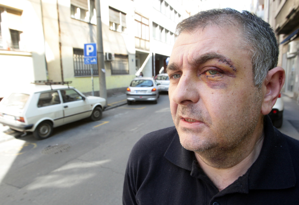 Privedene siledžije koje su brutalno izubijale oca devojčice sa Daunovim sindromom na Vračaru!