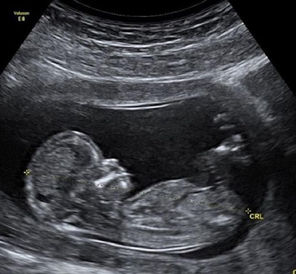 Poznati pevač objavio fotku ultrazvuka, svima se zgadio život kada su saznali kakva ISTINA se krije iza svega! (FOTO)