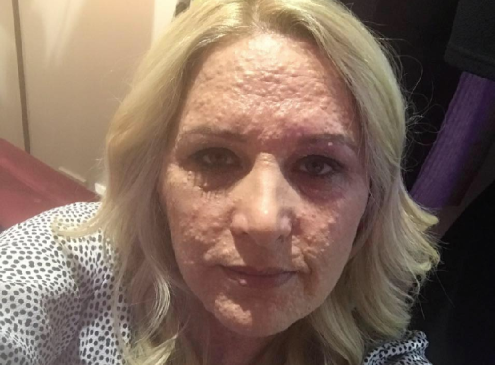 Ima tumore po celom telu, ljudi joj godinama dobacuju uvrede, a sada je spremna da napravi skandal! (FOTO)