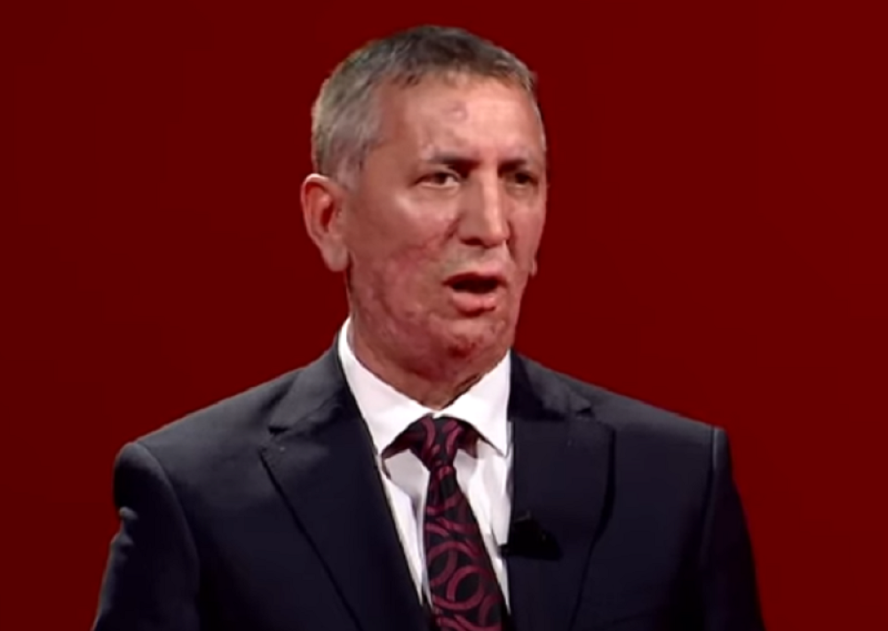 Šiptarski poslanik tvrdi da je bio na Košarama: Čim smo napali srpski komandir je PRVI POBEGAO!