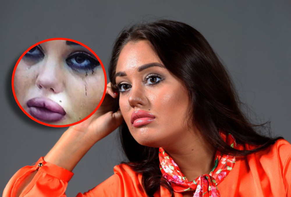 Ovo je pravo lice Ane Korać! Zumirana fotka uplakane starlete je nešto NAJJEZIVIJE što ćete danas videti! (FOTO)