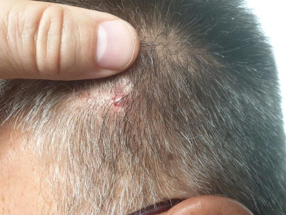 Zvezdin član uprave pokazao predmet kojim je gađan i osudio trenera Budućnosti! "Ovako nije bilo ni u Zagrebu"