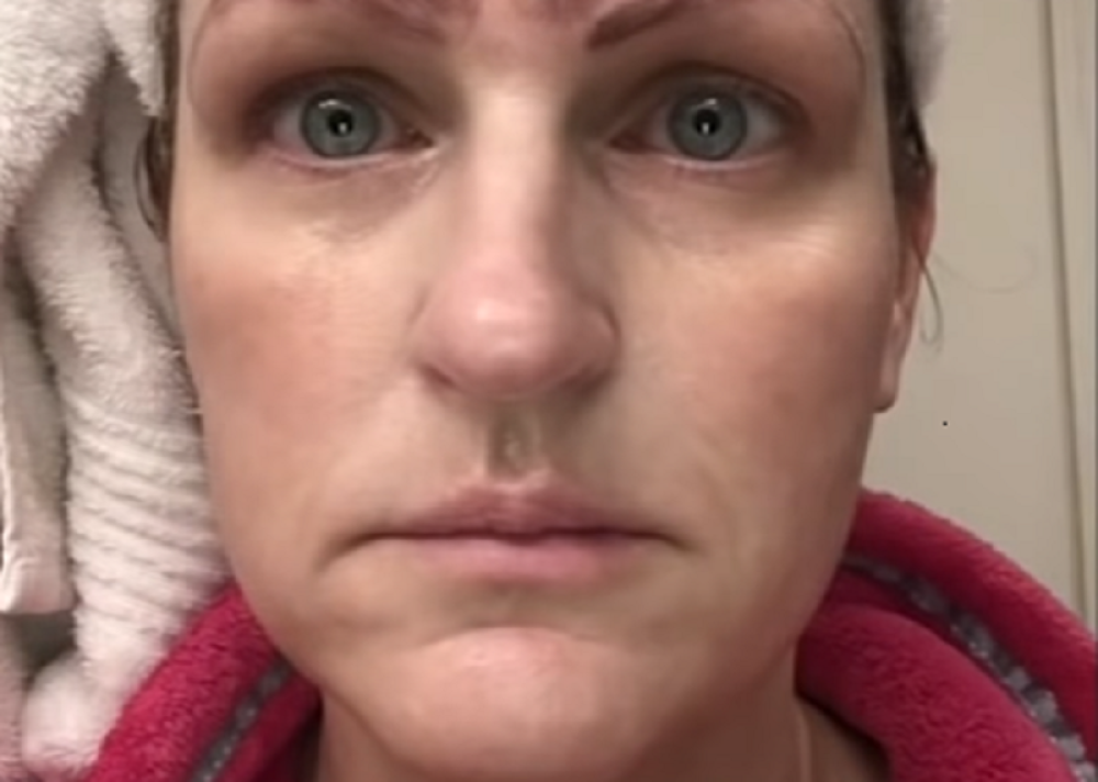 Htela je da ima lepe obrve, sada ih ima ČETIRI, kada je videla šta joj je uradila sa licem ostala je u šoku! (FOTO, VIDEO)